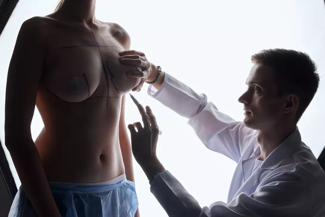 Cicatrice après une réduction mammaire